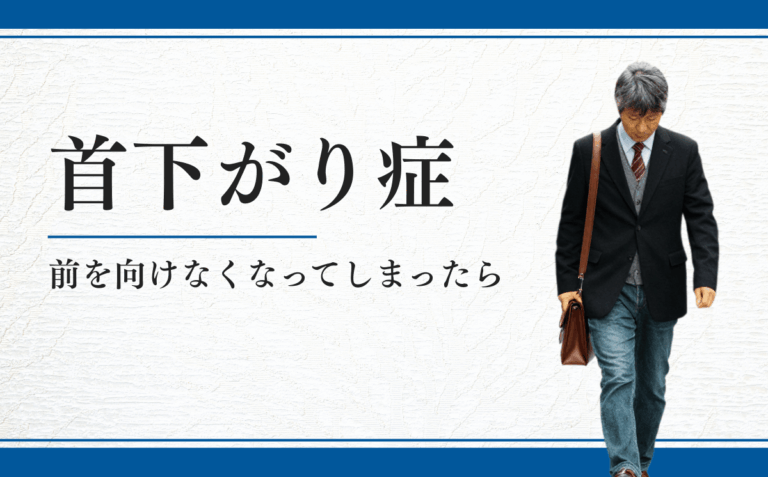 首下がり症
