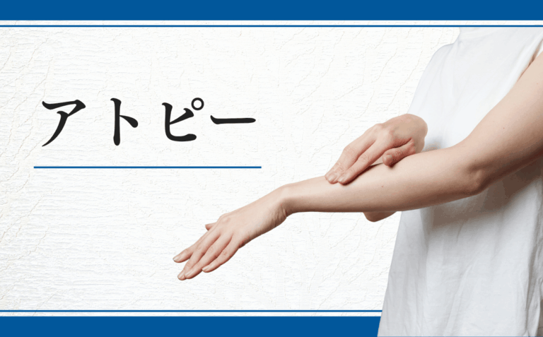 アトピー